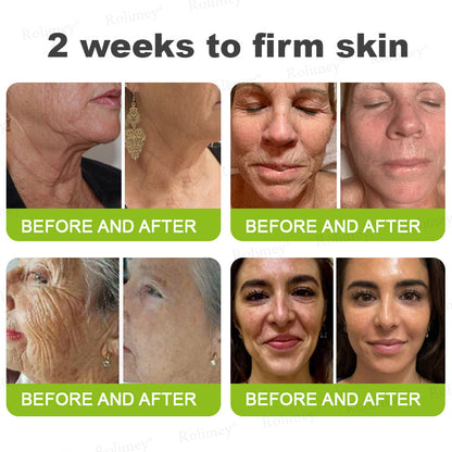 🇬🇧Made and shipped from the UK👉Rolimey® Botox & Vita-A Retinol Shot Wrinkle-Lift Tightening cream - Last Day Promotion 70% OFF