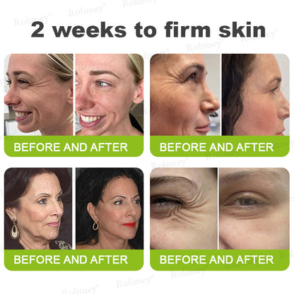 🇬🇧Made and shipped from the UK👉Rolimey® Botox & Vita-A Retinol Shot Wrinkle-Lift Tightening cream - Last Day Promotion 70% OFF