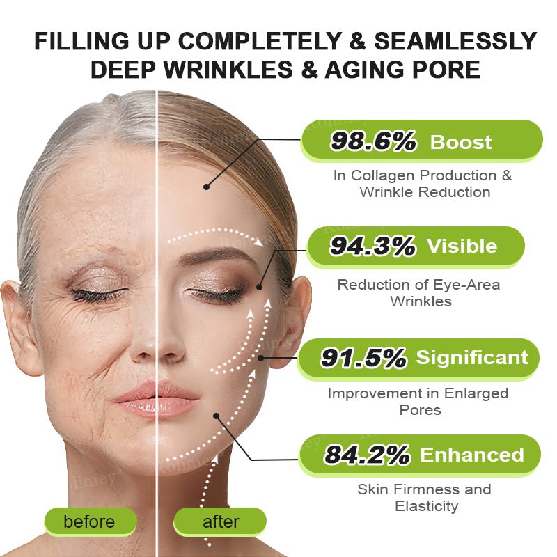 🇬🇧Made and shipped from the UK👉Rolimey® Botox & Vita-A Retinol Shot Wrinkle-Lift Tightening cream - Last Day Promotion 70% OFF