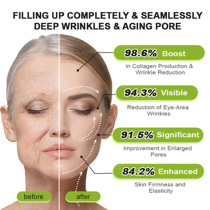 🇬🇧Made and shipped from the UK👉Rolimey® Botox & Vita-A Retinol Shot Wrinkle-Lift Tightening cream - Last Day Promotion 70% OFF