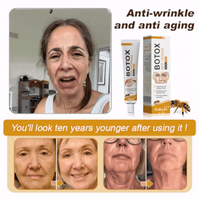 🌲👩‍⚕️(🐝Made and Shipped from UK✅) Furzero™ Botox Bee Venom Wrinkle Removal Cream- LAST DAY 70% OFF