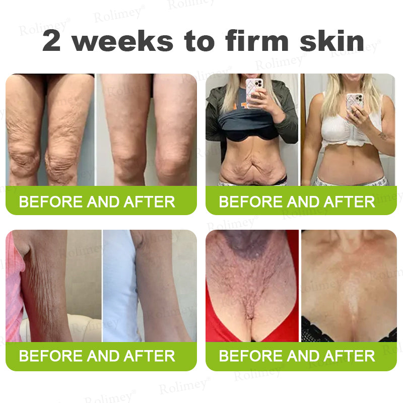🇬🇧Made and shipped from the UK👉Rolimey® Botox & Vita-A Retinol Shot Wrinkle-Lift Tightening cream - Last Day Promotion 70% OFF
