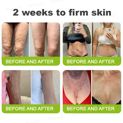 🇬🇧Made and shipped from the UK👉Rolimey® Botox & Vita-A Retinol Shot Wrinkle-Lift Tightening cream - Last Day Promotion 70% OFF
