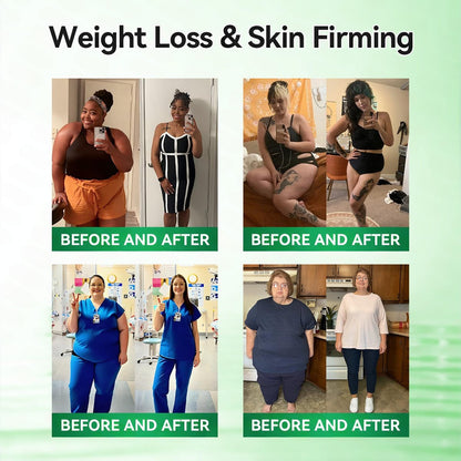 🌿𝑶𝒇𝒇𝒊𝒄𝒊𝒂𝒍 𝑺𝒕𝒐𝒓𝒆  | GFOUK®👨‍⚕️𝑴𝒐𝒓𝒊𝒏𝒈𝗮 · 𝗕𝗲𝗿𝗯𝗲𝗿𝙞𝙣𝙚 × 𝙉𝘼𝐃+ 𝟏𝟎-𝐢𝐧-𝟏 𝗔𝗱𝘃𝗮𝗻𝗰𝙚𝙙 𝙉𝙖𝙣𝙤 𝙈𝙞𝙘𝙧𝙤𝙣𝙚𝙚𝐝𝐥𝐞 𝐏𝐚𝐭𝙘𝙝(𝐉𝐮𝐬𝐭 𝐨𝐧𝐜𝐞 𝐚 𝐝𝐚𝐲, 𝐯𝐢𝐬𝐢𝐛𝐥𝐞 𝐜𝐡𝐚𝐧𝐠𝐞𝐬 𝐢𝐧 𝟕 𝐝𝐚𝐲𝐬）  𝐅𝐨𝐫 𝐨𝐛𝐞𝐬𝐢𝐭𝐲, 🅛🅞🅞🅢🅔 🅢🅚🅘🅝,𝐝𝐢𝐚𝐛𝐞𝐭𝐞𝐬, 𝐬𝐥𝐞𝐞𝐩 𝐚𝐩𝐧𝐞𝐚, 𝐣𝐨𝐢𝐧𝐭 𝐢𝐬𝐬𝐮𝐞𝐬, 𝐚𝐧𝐝 𝐦𝐨𝐫𝐞