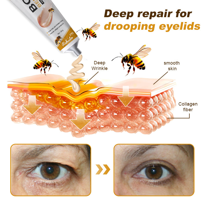 🌲👩‍⚕️(🐝Made and Shipped from UK✅) Furzero™ Botox Bee Venom Wrinkle Removal Cream- LAST DAY 70% OFF