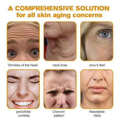 🌲👩‍⚕️(🐝Made and Shipped from UK✅) Furzero™ Botox Bee Venom Wrinkle Removal Cream- LAST DAY 70% OFF